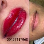 فیکانتور لب 3 IMG 20221026 WA0014
