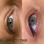 تاتو بن مژه 3 IMG 20221026 WA0132