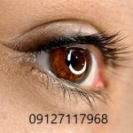 میکروپیگمنتیشن چشم 3 شیدینگ چشم