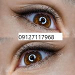 شیدینگ چشم 6 IMG 20221026 WA0143