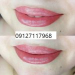 میکروپیگمنتیشن لب 4 IMG 20221026 WA0161