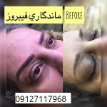 آموزش میکروپیگمنتیشن ابرو 3 IMG 20221026 WA0088