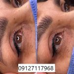 قیمت تتو چشم 6 هزینه فیبروز ابرو در تهران در سال1402 در تهران چقدر است؟