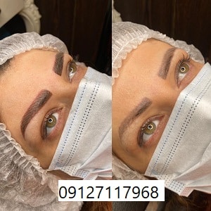 هزینه میکروبلیدینگ ابرو چقدر است؟
