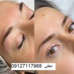 ترمیم هاشور ابرو 4 بهترین مرکز فیبروز ابرو در تهران کجاست و هزینه فیبروز ابرو چقدر است؟