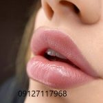 ترمیم تاتو لب 5 IMG 20221205 232135 398