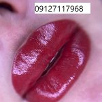 ترمیم تاتو لب 6 IMG 20221205 232135 622