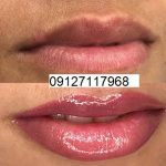تاتو لب طبیعی 5 IMG 20221205 232153 363