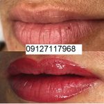 تاتو لب طبیعی 6 IMG 20221205 232153 533