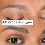 ترمیم میکروپیگمنتیشن ابرو 2 IMG 20221214 005453 942