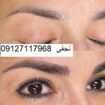 ترمیم میکروپیگمنتیشن ابرو 5 IMG 20221214 005500 543