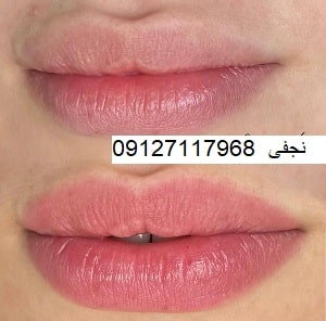 تاتو لب به روش میکروبلیدینگ 5 IMG 20221214 005501 470