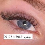 کاشت مژه گربه ایی 1 IMG 20221231 210814 731