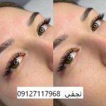 کاشت مژه گربه ایی 2 IMG 20221231 210814 872