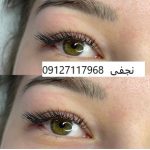 کاشت مژه گربه ایی 3 IMG 20221231 210814 882