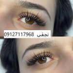 کاشت مژه گربه ایی 4 IMG 20221231 210815 008