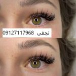 کاشت مژه گربه ایی 5 IMG 20221231 210832 678