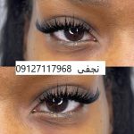 کاشت مژه گربه ایی 6 IMG 20221231 210832 727