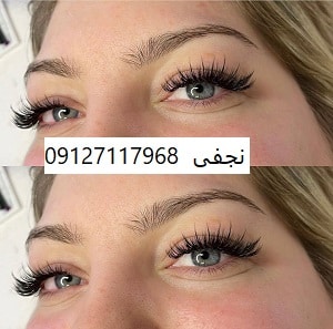 کاشت مژه کایلی 1 IMG 20221231 210833 364
