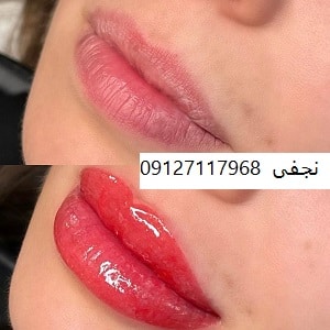 تاتو لب به روش میکروبلیدینگ 2 IMG 20221231 220339 479