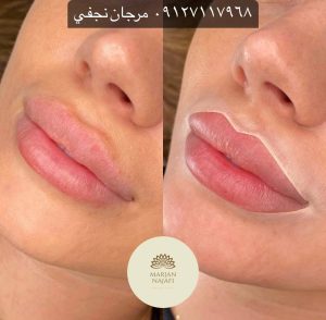 قیمت تاتو رژ لب دائم در سال 1402 چقدر است؟