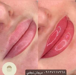 قیمت خط لب 12 تاتو لب در مرجان فیبروز