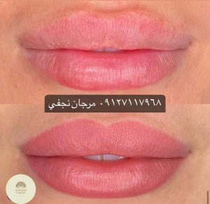 قیمت خط لب 13 قیمت تاتو خط لب یا تاتو لب در تهران در سال1402 چقدر است؟