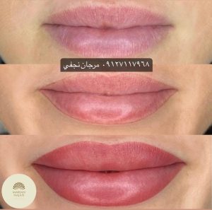 قیمت خط لب 11 بهترین مرکز تاتو خط لب و شیدینگ لب در تهران کجاست؟