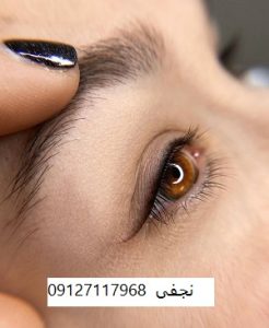 قیمت بن مژه 15 قیمت بن مژه در تهران چقدر است؟