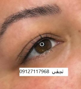 قیمت بن مژه 12 قیمت بن مژه در تهران چقدر است؟