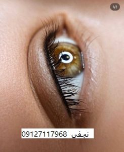 قیمت بن مژه 14 قیمت بن مژه در تهران چقدر است؟