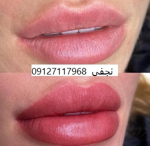 ارزانترین و بهترین تاتو رژ لب دائم در تهران در مجموعه مرجان فیبروز با ماندگاری بسیار بالا و تضمین استفاده از رنگ های درجه 1