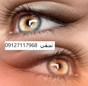 قیمت بن مژه 8 قیمت بن مژه در تهران چقدر است؟
