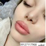 میکروپیگمنتیشن رژ لب 3 قیمت تاتو رژ لب