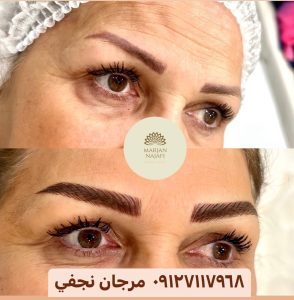 قیمت تاتو ابرو در تهران