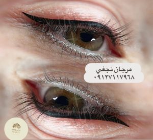 قیمت تاتو خط چشم 30 تاتو شیدینگاین مدل که به آن سایه چشم نیز گفته میشود بصورت نقطه ای پشت پلک انجام میشود. در این روش چشمها همیشه دارای سایه می باشند. مدل مناسب برای فرم های مختلف چشم های ریز می باشند، برای درشت نشان دادن چشم هایشان، تتو خط چشم برای پلک بالا و پلک پایین را انجام دهند. چشم های برجسته این افراد باید تاتو خط چشم پهن برای پلک بالا استفاده کنند. چشمهای گرد این افراد باید تاتو خط چشم پلک بالا را انجام دهند بدین صورت ابتدای چشم خطی ظریف کار شود و رفته رفته تا به انتها خط چشم پهن شود. چشمهای نزدیک به هم این افراد باید نیمه تتو را انجام دهند تا با فاصله بنظر آیند. نکاتی که باید قبل از تاتو خط چشم به آن توجه شود: برای انجام تتو چشم مکانی را انتخاب کنید که ضمن ماهر و حرفه ای بودن کادر آن، اصول و بهداشت در انجام کار را رعایت کنند. چشمها یکیاز حساس ترین اعضای بدن می باشند و امکان عفونت در آن ها بسیار بالا است. بنابراین از تتو کار خود درخواست وسایل و ابزار تازه و استریل شده کنید. قبل انجام، صورت خود را کاملا شسته و تمیز کنید. و از پاک بودن پوست اطراف از آرایش مطمئن شوید. قبل شروع از آرایشگر و یا تکنسین بخواهید مدل خط را با مداد برای شما بکشد تا درباره مدل قطعی آن صحبت کنید. زیرا نمی توانید مدل آن را بعد تغییر دهید. سعی کنید یک روز قبل انجام تتو از مصرف داروهایی مانند آسپرین و ویتامین E و نوشیدنی های کافئین دار و همچنین الکل خود داری کنید. زمان انجام تتو چشمهای خود را بسته نگه دارید تا مواد بی حسی اطراف ،به داخل چشمها نرود زیرا آسیب جدی به چشمها وارد میکند. در آخر بهیاد داشته باشید تاتو خط چشم مانند دیگر تتو ها برای ماندگاری نیاز به ترمیم دارد. چه زمانی بعد از تاتو خط چشم می توان استحمام کرد؟ برای جلوگیری از قرار گرفتن ناحیه تحت درمان در معرض بخار زیاد، می توانید سریع دوش بگیرید. هنگامی که دوش می گیرید، قرار گرفتن در معرض آب داغ و هرگونه قرار گرفتن مداوم در معرض آب را در آن ناحیه به حداقل برسانید. با رعایت تمامی موارد میتوانید ماندگاری تاتو خط چشم را افزایش دهید. چرا تاتو خط چشم بعد از مدتی به فیروزه ای تغییر رنگ می دهد؟ رنگدانه آبی به جا مانده بر اثر تاتو خط چشم به طور دائم در پوست باقی می ماند و متأسفانه به خودی خود از بین نمی رود. این مشکل را می توان به دو روش درمان کرد: ممکن است یک رنگدانه گرم در بالای آن اعمال شود تا تن سرد را خنثی کند، یا یک گزینه بهتر و آن استفاده از لیزر است. گزینه اول ممکن است به چندین روش نیاز داشته باشد. همچنین دوام زیادی ندارد زیرا رنگدانه آبی پس از مدتی دوباره ظاهر می شود و از بین نمیرود. نتیجه به عوامل زیادی بستگی دارد مانند؛ غلظت رنگدانه آبی و عمق آن چقدر است. راه دوم برای اصلاح ابروهای آبی، برداشتن آنها با لیزر است. حذف لیزر باعث اصلاح آرایش بسیار بهتر می شود. رنگ آبی محو می شود و کمتر متراکم به نظر می رسد، سپس رنگدانه صحیح جدید را می توان برای نتیجه دلخواه اعمال کرد. برای جلوگیری از آبی شدن تاتو خط چشم باید به مرکزی مراجعه نمایید که حتما از رنگ های با کیفیت در تاتو خط چشم استفاده نماید تا گذر زمان باعث از بین رفتن رنگ و تغییر آن نشود. دوره های انجام تاتو خط چشم لازم است تتو کار دوره های مخصوص تاتو خط چشم را دیده باشد تا از بروز هر گونه خطر و بیماری برای مراجعه کننده جلوگیری شود. تتو کار حرفه ای و تخصصی برای انتخاب مدل به مشتری دید باز میدهد، یعنی تمام طرح های مد روز و مدل های مختلفی به مشتری کمک میکند ظاهری دلنواز تر و چشمگیر تر داشته باشد را معرفی می کند.در نهایت انتخاب به عهده مشتری است که با توجه به مدل ها و هزینه تاتو خط چشم گزینه مورد نظر خود را انتخاب کند. هزینه برای کسانیکه از داشتن ابرو های کم پشت ریخته شده اذیت میشوند نیز هزینه ای کارامد به شمار می رود. بعد اتمام کار و گذشت مدت زمانی، ارائه خدمات شارژ تتو نیز برای مشتریان اهمیت ویژه ای دارد، شارژ تاتو، باید با همان کیفیتی که برای بار اول تتو روی صورتشان انجام شده، صورت گیرد. حتی گاهی برخی افراد پس از مدتی قصد تعویض مدل تتو و یا بطور کلی پاک کردن آن را دارند. وقتی کسی هزینه را می پردازد، نباید فکر کند که فقط یک بار است بلکه باید برای شارژ آن هم پس اندازی کنار بگذارد. دوره های انجام تاتو خط چشم عوارض تتو خط چشم چیست؟ تاکنون هیچگونه عارضه ای در رابطه با تاتو خط چشم گزارش نشده است. تنها عارضه که آن هم تنها بدلیل تتو است این است بعد تتو اطراف چشمتان مقداری قرمز خواهد شد و ممکن است مقداری هم سوزش احساس کنید. اگر فکر میکنید پوست بسیار حساسی دارید و باید بیشتر از هرکس دیگری تحت درمان قرار میگیرد مراقب باشید، میتوانید چند روز قبل درمان، تست حساسیت پوستی را در ناحیهای مشخص نیست انجام دهید تا ببینید پوست شما چگونه واکنش نشان میدهد. چه افرادی نمیتوانند تتو خط چشم انجام دهند؟ تاتو خط چشم یک روش درمانی است که کاملا ایمن است اما موارد منع مصرف دارد که به گفته متخصصان، افرادیکه به رنگدانه آلرژی دارند ،زنان باردار،افراد نیازمند به ترمیم کلوئید، موجود در پلک یا افرادیکه در حال شیمی درمانی هستند گزششنه مناسبی برای انجام این روش زیبایی نمیباشند. آیا تاتو خط چشم دائمی دردناک است؟ اینکه می گویند دائمی بدون درد است، دروغ محض است. حقیقت این است این یک درمان است که می تواند باعث ناراحتی شود، با این حال، درد بسیار قابل تحمل است و عملا شما تنها مقداری سوزش را احساس خواهید کرد. همچیز درباره درد ان بستگی به آستانه درد شما دارد که میتواند تعیین کننده تحمل شما باشد. دلیل اینکه تتو خط چشم می تواند باعث ایجاد نوعی درد شود این است که برای انجام این روش از ابزاری بنام درموگراف استفاده میشود که با ایجاد حرکات الکتریکی، میکروپیگمنت ها را وارد پوست شما میکند. این کار با استفاده از سوزنی انجام میشود که رنگدانه ها را در عمقی بین 0.7 تا 1.7 میلی متر اعمال میکند. بسته به دستگاه مورد استفاده، اندازه سوزن تغییر میکند و می توان از انواع سوزن با سرهای مختلف استفاده کرد. نکاتی که لازم است قبل از تتو به آن دقت نمایید قبل از انجام باید بدانیم که این روش یک درمان نیمه دائمی است و مانند خظ چشم دائمی نیست که اگر از ان پشیمان شدیم بتوانیم آن را پاک نماییم. ناپدید شدن کلی رنگدانه بسته به سایه اعمال شده و شدت آن، ناحیه اعمال و پاسخ پوست کاربر می تواند تا 10 سال یا بیشتر طول بکشد. مدت زمان ماندگاری بسیار متغیر است زیرا بستگی زیادی به هر نوع پوست دارد و میانگین آن بین 2 تا 5 سال است. باید بدانید اگر می خواهید رنگ اولیه را برای مدت طولانی تری حفظ کنید، تتو بعد از گذشت یک سال از درمان باید بررسی شود، به استثنای مواردی که پوست در دوره های 6 تا 8 ماهه رنگدانه را پس می زند. شما باید بدرستی اطلاع داشته باشید تا بدانید این مدل تتو چیست و مطمئن شوید که هیچ خطری در مورد سلامتی شما وجود نداردحتما قبل اقدام بهاین کار با یک متخصص مشورت نمایید. بهترین مرکز تاتو خط چشم در تهران چشم یکی از نقاط حساس بدن میباشد که هنگام اعمال هر نوع مواد آرایشی و یا خدمات زیبایی بر آن باید کارها را با دقت زیادی انجام دهیم زیرا آسیب وارد کردم به چشم دارای تبعات بسیار زیادی میباشد. برای تاتو خط چشم بهتر است به بهترین مرکز برای انجام آن مراجعه نمایید تا تتو بدون ایجاد هیچگونه مشکلی برایتان انجام شود. در بهترین مرکز تمامی مراحل تتو زیر نظر متخصص و با استفاده از بهترین متریال و دستگاه مناسب تتو انجام میگیرد. با توجه به انجام آن توسط متخصص درصد خطا به حداقل میرسد و شما میتوانید با خیال راحت به این مرکز مراجعه کرده و از نتیجه کار خود لذت ببرید. تتو خط چشم در کلینیک دکتر تاتو و مزایا آن بهتر است تاتو خط چشم را حتما در مراکز معتبر انجام دهید و از انجام آن نزذ هر فردی خودداری نمایید. یک شخص آماتور میتواند باعث آسیب به چشمانتان شود و یا از لوازم و مواد اولیه نامرغوب استفاده نماید. اما در کلینیک دکتر تتو ، از بهترین مواد اولیه و به روزترین دستگاه ها استفاده میشود. تمامی مراحل زیر نظر پزشک متخصص بوده و هزینه آن بسیار به صرفه میباشد. شما میتوانید با خیال راحت تمامی سوابق و نمونه کارهای ما در هر زمینه ای را بررسی نمایید و سپس جهت دریافت نوبت اقدام نمایید. در کلینیک دکتر تاتو تمامی مراحل تاتو خط چشم طبق نظر مشتری و با استفاده از رنگ های با کیفیت انجام میگیرد.
