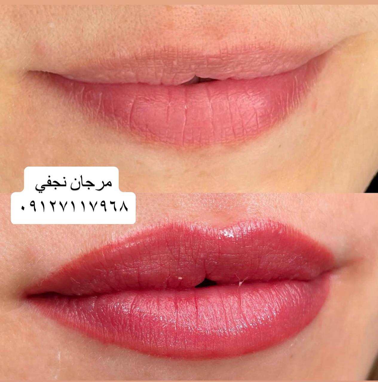 قیمت شیدینگ لب در مجموعه مرجان فیبروز در سال 1402 چقدر است