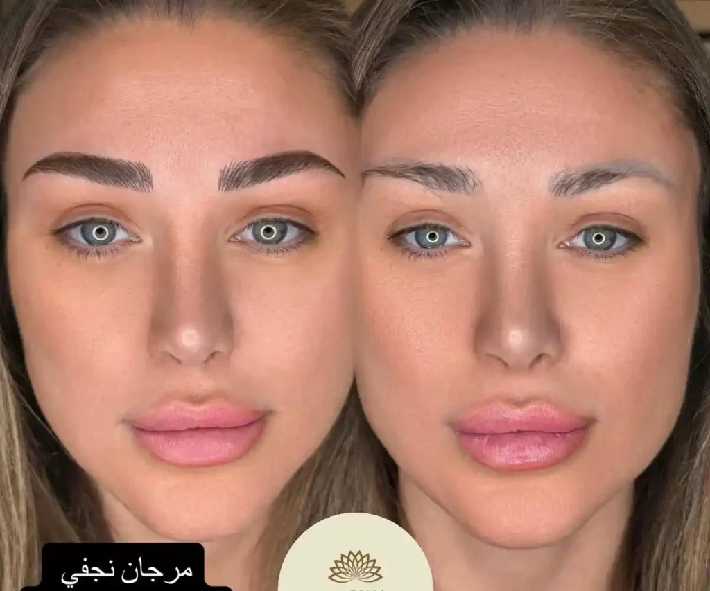 فرم ابرو (15)