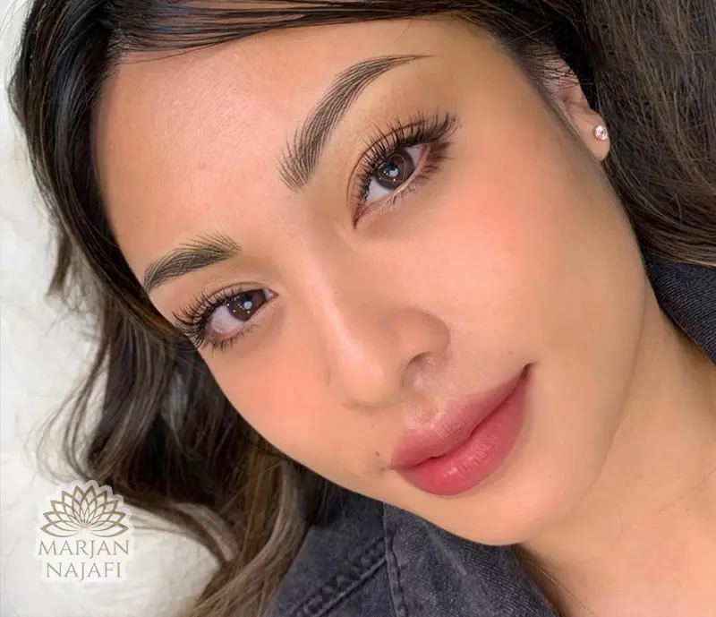 آموزش فیبروز ابرو