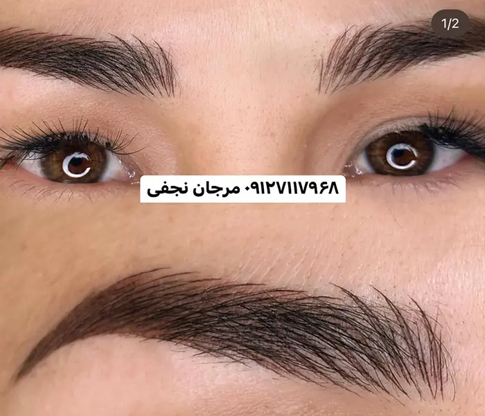 آیا میتوانم فیبروز ابرو را خودم انجام دهم؟ 1 تصویر فیبروز ابرو حرفه ای