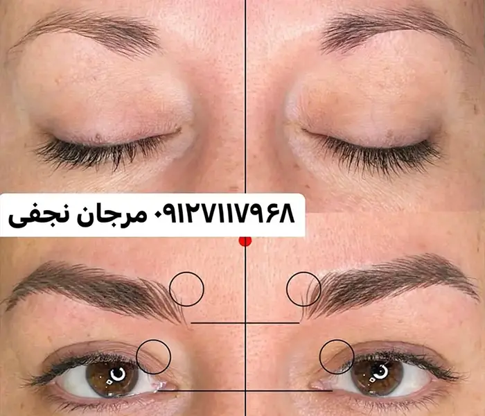 آیا میتوانم فیبروز ابرو را خودم انجام دهم؟ 2 فیبروز ابرو آموزش