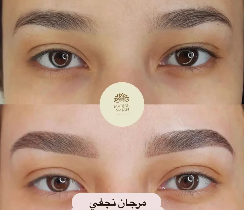 مزایای فیبروز ابرو نسبت به تاتو چیست؟ 11 فیبروز ابرو