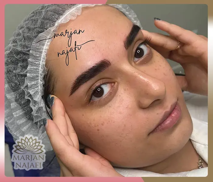 نمونه فیبروز
