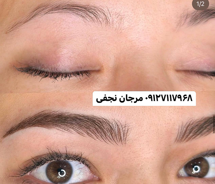 فیبروز ابرو