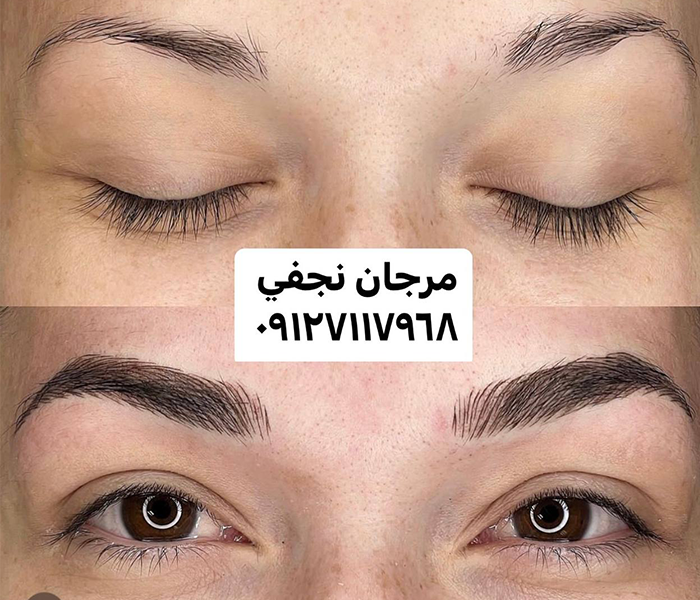 قبل و بعد ابروی کم پشت با فیبروز