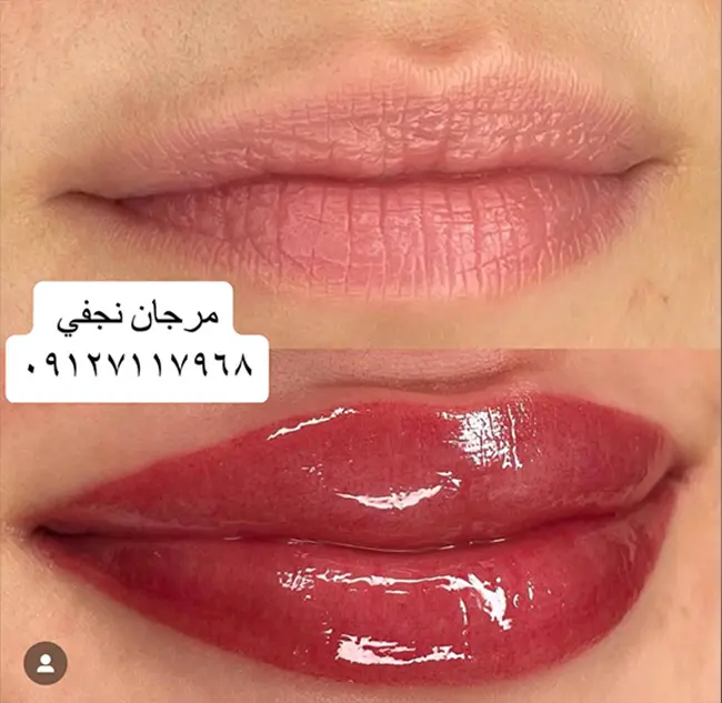 بهترین قیمت شیدینگ لب در مرزداران و غرب تهران در سال 1402 در تهران چقدر است و کجاست؟