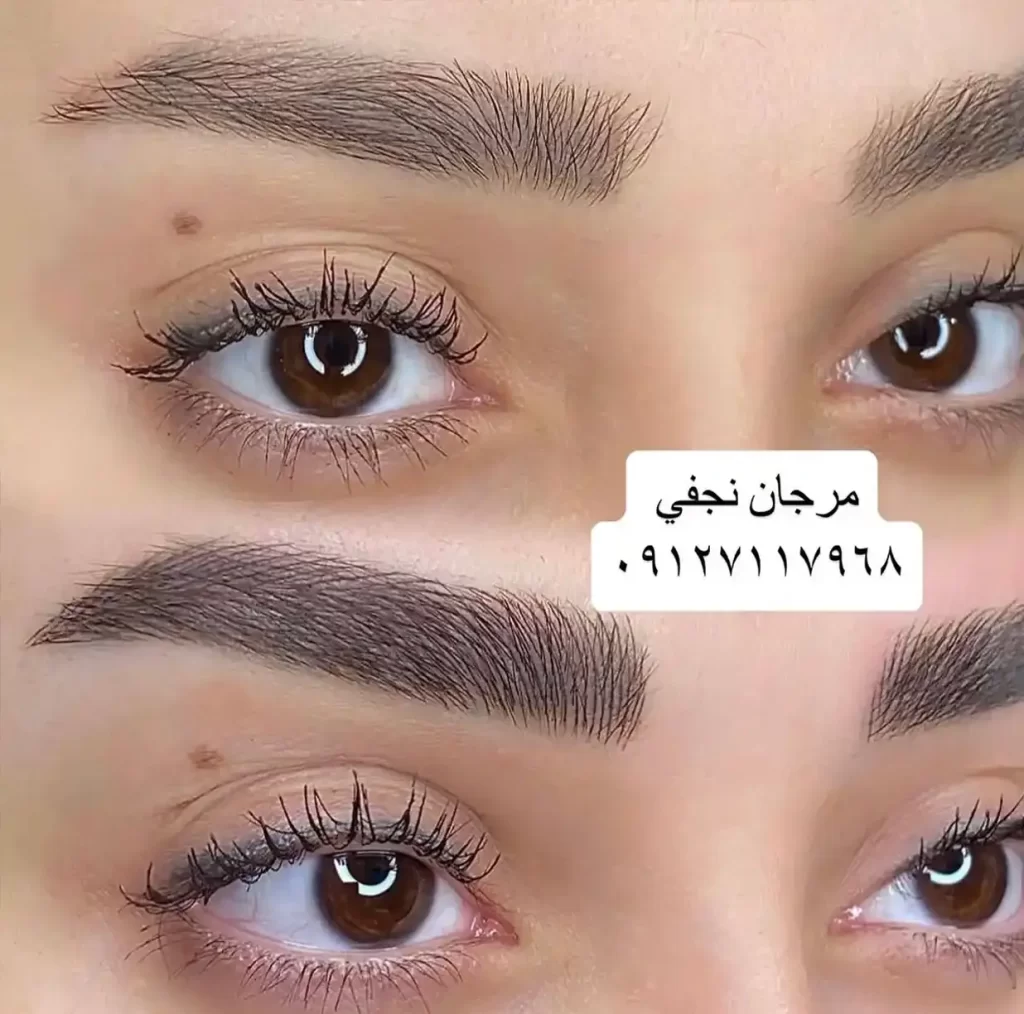 آموزش فیبروز ابرو