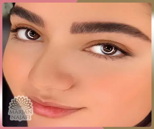 های فیبروز ابرو