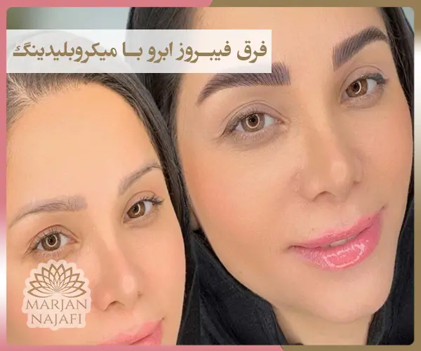 فرق فیبروز ابرو با میکروبلیدینگ چیست