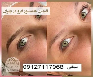 قیمت فیبروز ابرو در تهران